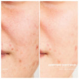 refreshing face sheet mask